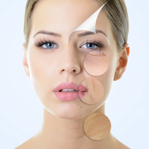 Micro needling